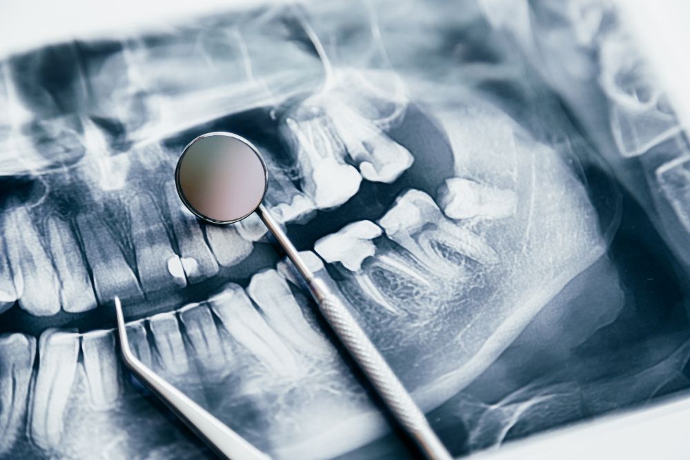 Oral Medicine & Radiology